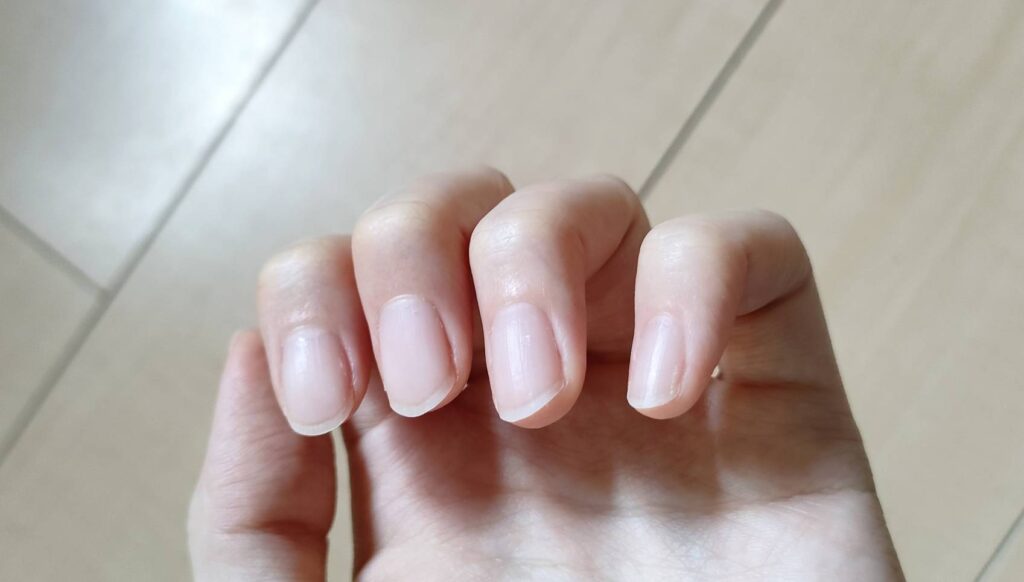 ohoraネイルオフ後の爪