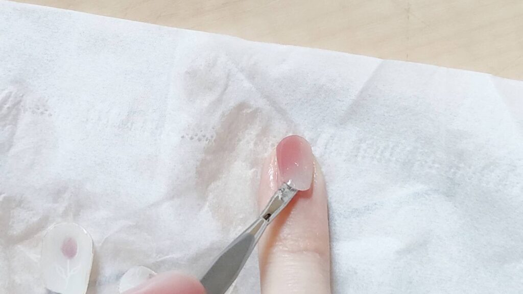 オホーラネイルオフ手順